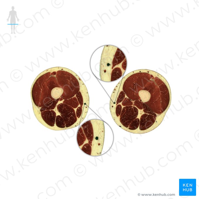 Veia safena magna (Vena saphena magna); Imagem: National Library of Medicine