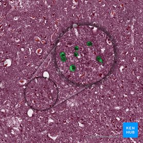 Neurons (Neurofibrae); Image: 