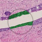 Stratified epithelium