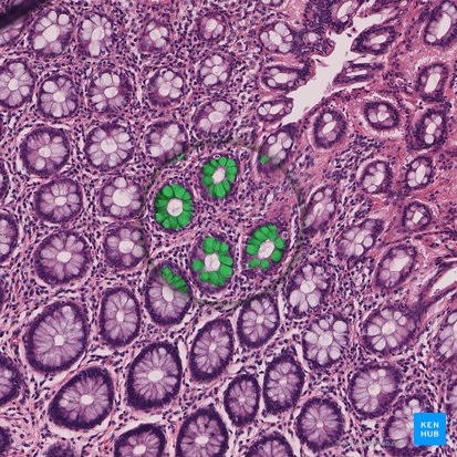 Goblet cell (Exocrinocytus caliciformis); Image: 