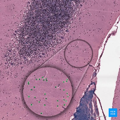 Basket cell of cerebellum (Neuron cobiforme); Image: 