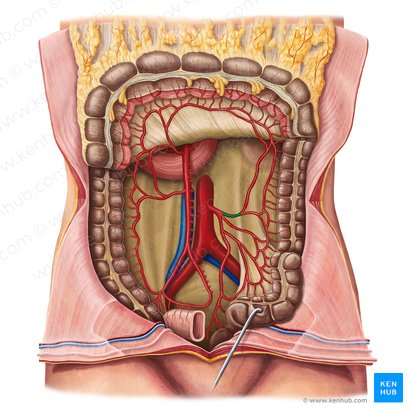 Arteria colica sinistra (Linke Dickdarmarterie); Bild: Irina Münstermann