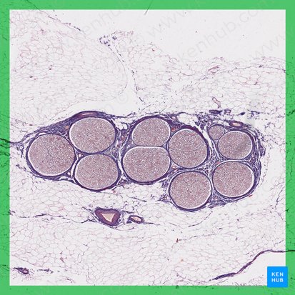 Cross section of peripheral nerve; Image: 