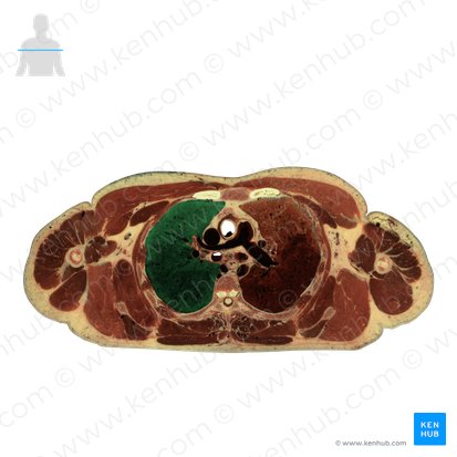 Right lung (Pulmo dexter); Image: National Library of Medicine