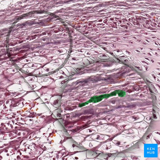 Isogenous group of chondrocytes (Aggregatio isogenica chondrocyti); Image: 