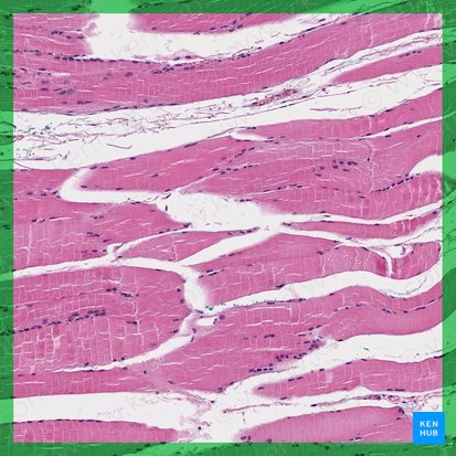 Skeletal muscle (Textus muscularis skeletalis); Image: 