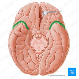 Sulco lateral (Sulcus lateralis); Imagem: Paul Kim