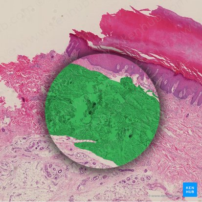 Camada reticular da derme (Stratum reticulare dermis); Imagem: 