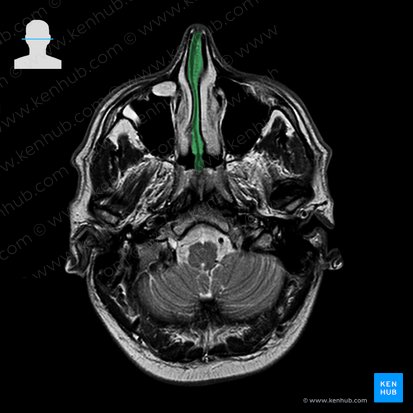 Nasal septum (Septum nasi); Image: 