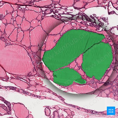 Folliculus thyroideus (Schilddrüsenfollikel); Bild: 