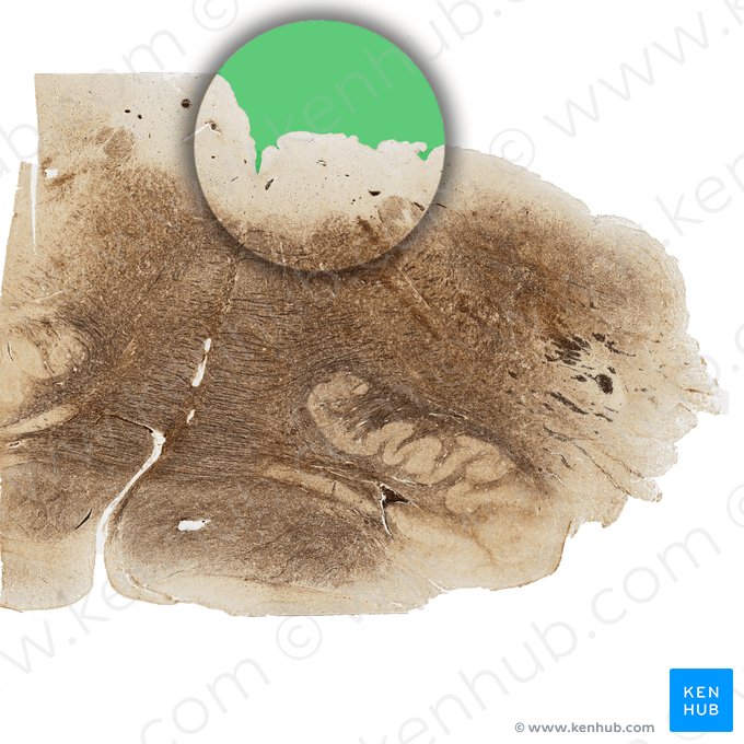 Cuarto ventrículo (Ventriculus quartus); Imagen: 