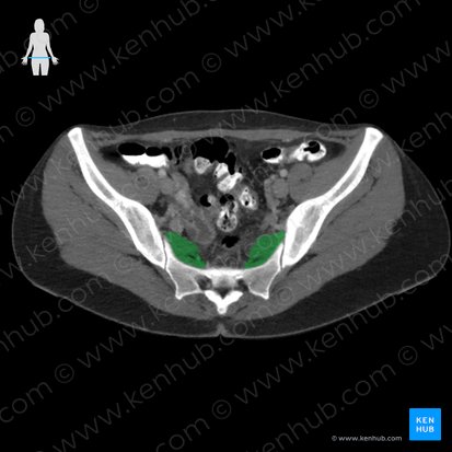 Piriformis muscle (Musculus piriformis); Image: 