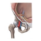 Canal inguinal