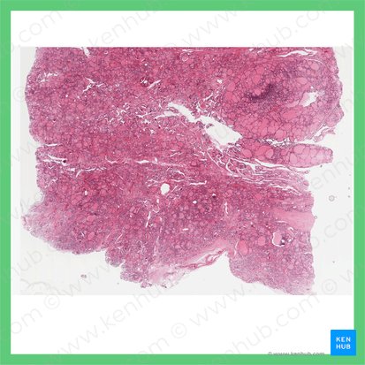 Thyroid gland (Glandula thyroidea); Image: 