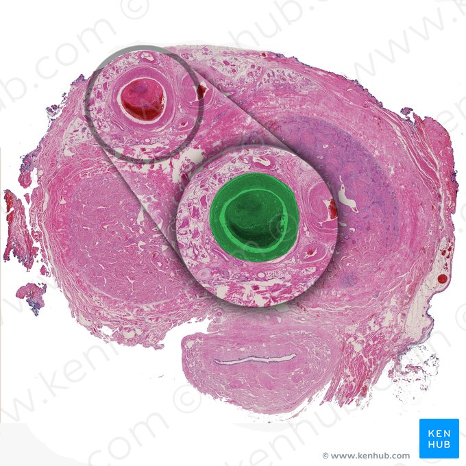 Vena dorsal profunda del pene (Vena dorsalis profunda penis); Imagen: 