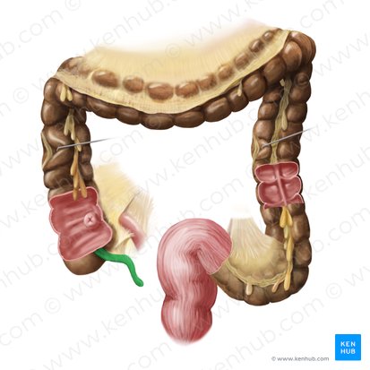 Appendix vermiformis (Wurmfortsatz); Bild: Begoña Rodriguez
