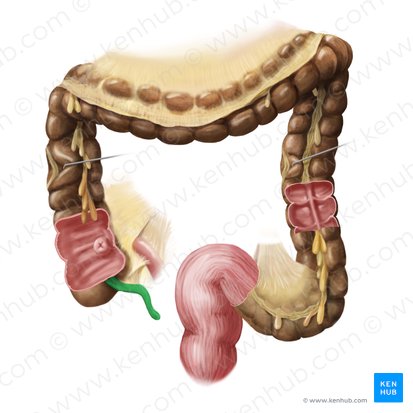 Apéndice vermiforme (Appendix vermiformis); Imagen: Begoña Rodriguez