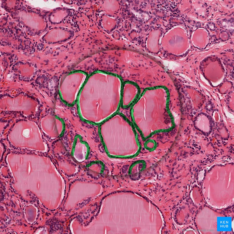 Simple epithelium: Location, function, structure | Kenhub