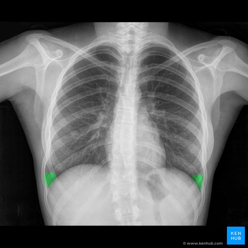 Recessos costodiafragmáticos: Vista anterior