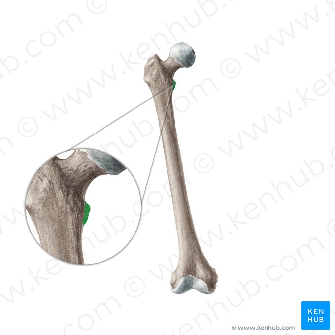Trochanter minor ossis femoris (Kleiner Rollhügel des Oberschenkelknochens); Bild: Liene Znotina