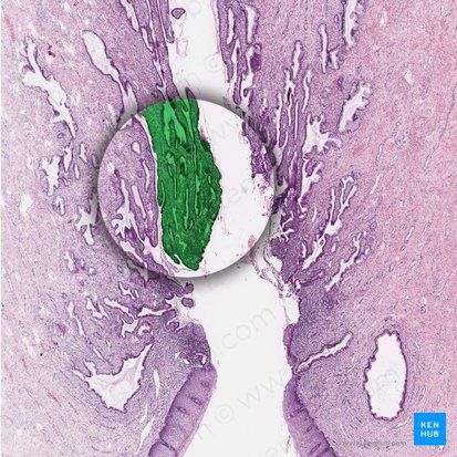 Simple columnar epithelium of endocervix; Image: 