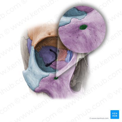 Foramen infraorbitale maxillae (Unteraugenhöhlenloch des Oberkieferknochens); Bild: Paul Kim