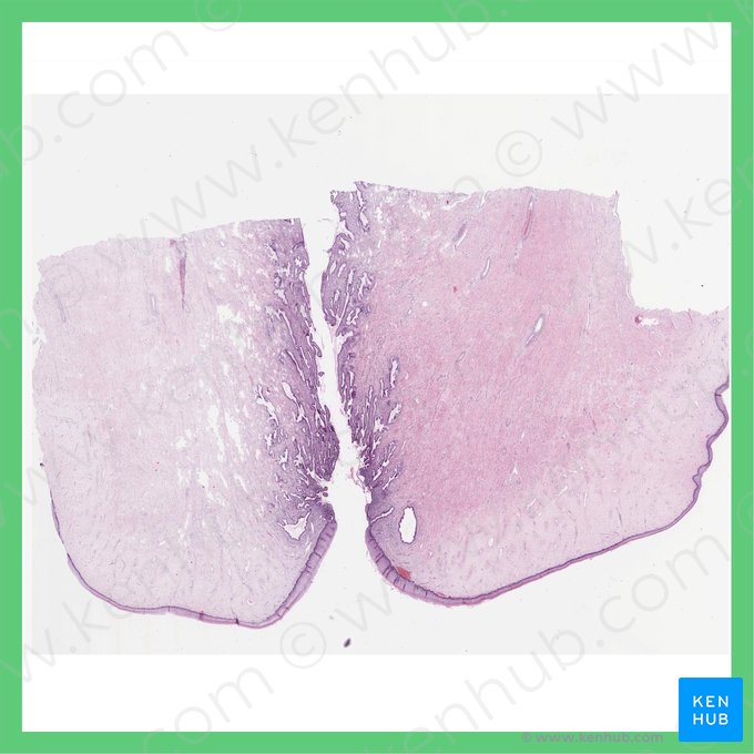 Cuello uterino (Cervix uteri); Imagen: 