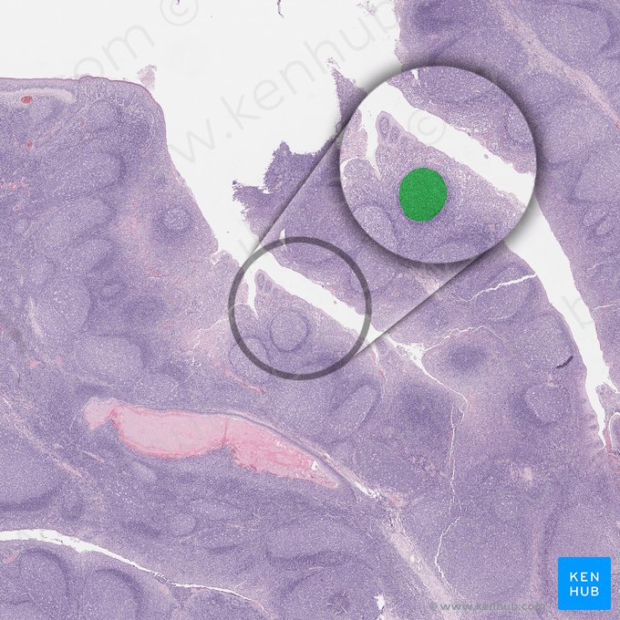 Germinal center (Centrum germinalis); Image: 