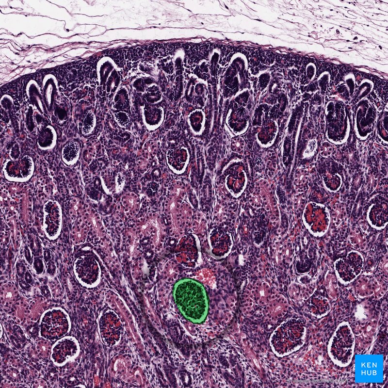 Renal corpuscle - Histological slide (H&E)