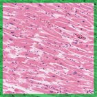 Cardiac muscle tissue