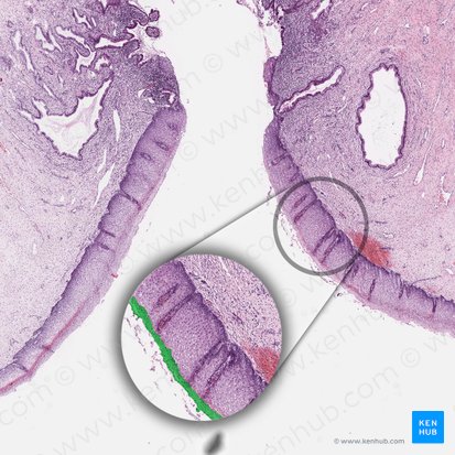 Superficial cell layer of squamous epithelium; Image: 