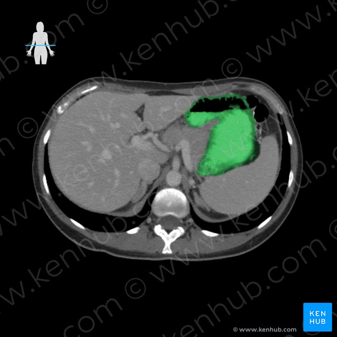 Stomach (Gaster); Image: 