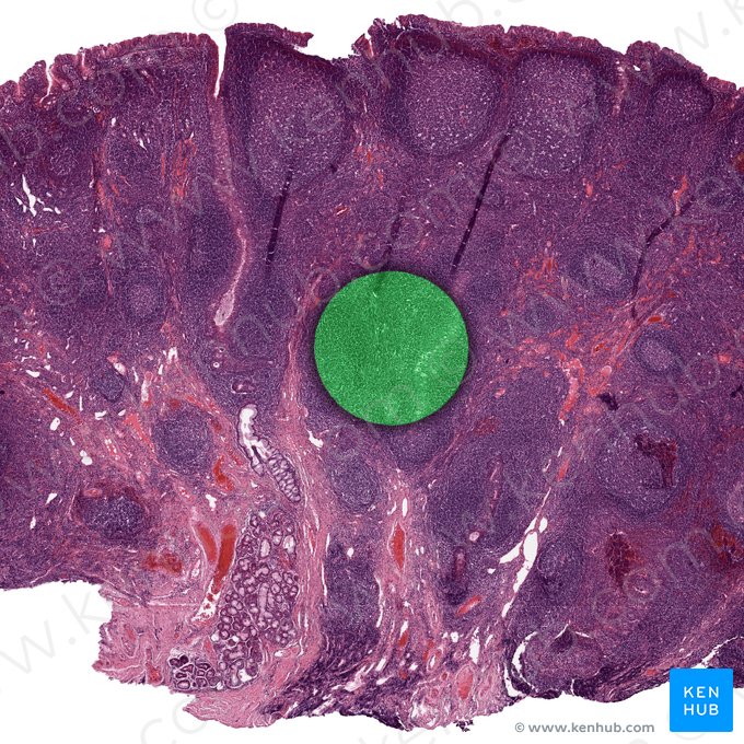 Tecido conjuntivo reticular; Imagem: 