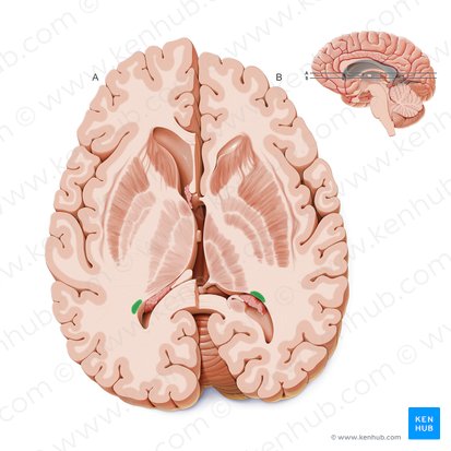 Cola del núcleo caudado (Cauda nuclei caudati); Imagen: Paul Kim