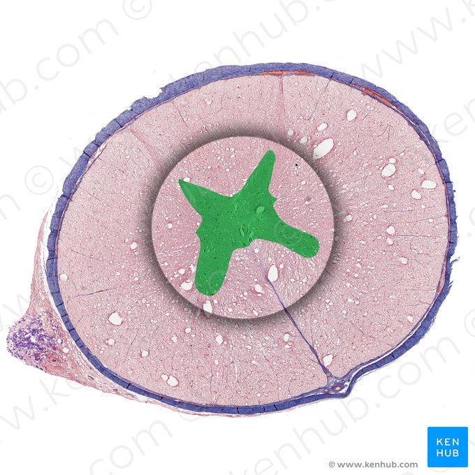 Sustancia gris (Substantia grisea); Imagen: 