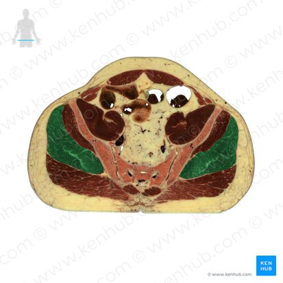 Músculo glúteo médio (Musculus gluteus medius); Imagem: National Library of Medicine