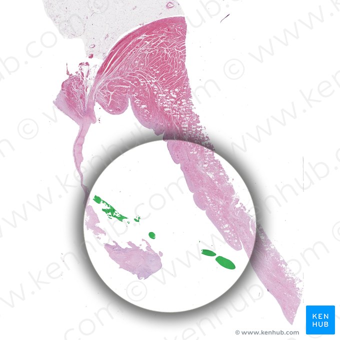 Cuerdas tendinosas de la valva atrioventricular izquierda (Chordae tendineae valvae atrioventricularis sinistrae); Imagen: Yousun Koh