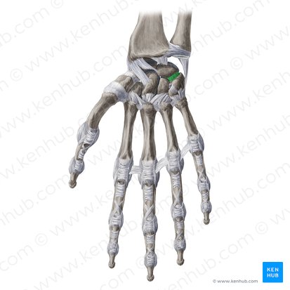 Ligamentum lunotriquetrum palmare (Hohlhandseitiges Mondbein-Dreiecksbein-Band); Bild: Yousun Koh