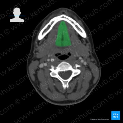 Genioglossus muscle (Musculus genioglossus); Image: 