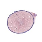 Medula espinal