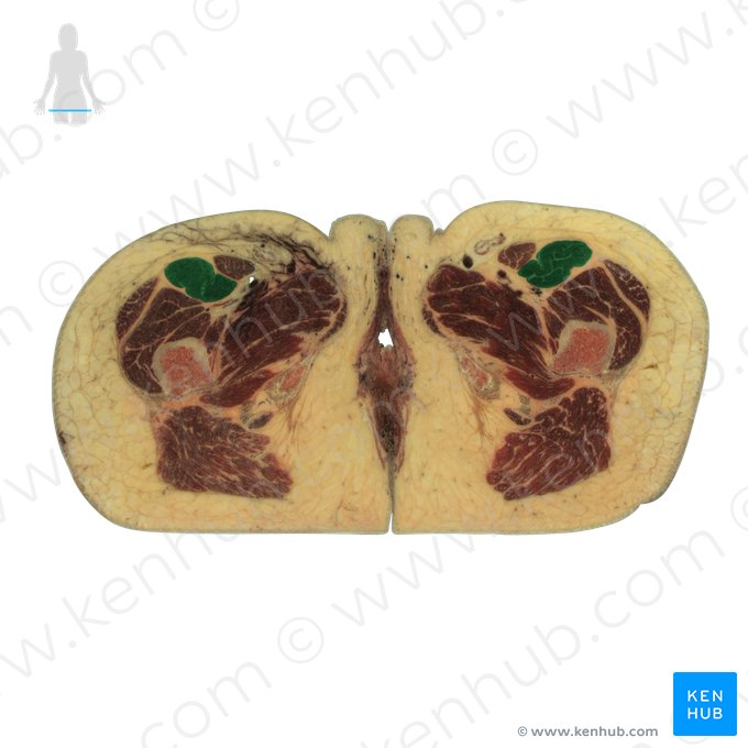 Músculo reto femoral (Musculus rectus femoris); Imagem: National Library of Medicine