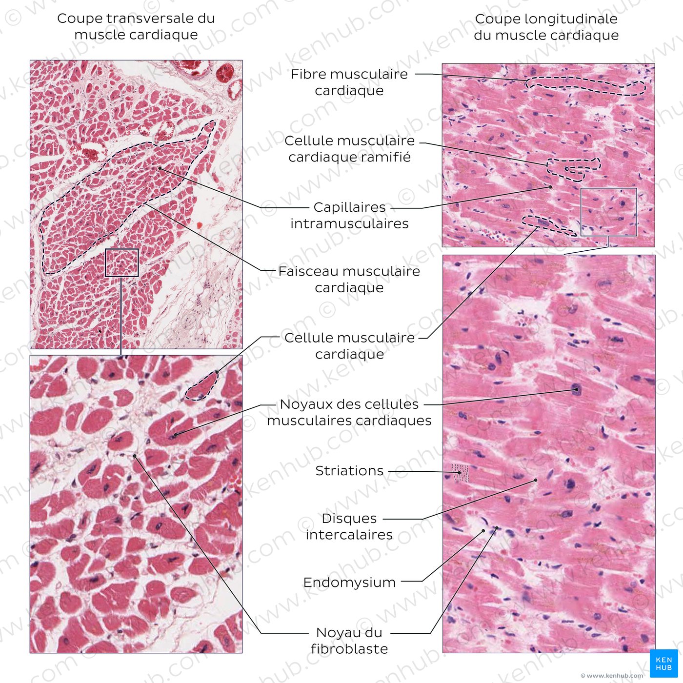 Cardiac muscle
