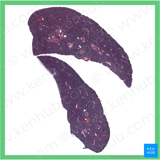 Fetal lung (pseudoglandular stage) (Pulmo fetalis (tempus pseudoglandulare)); Image: 