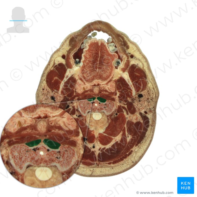 Músculo longo do pescoço (Musculus longus colli); Imagem: National Library of Medicine