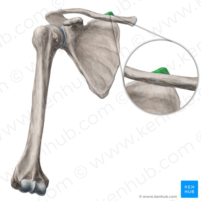 Angulus superior scapulae (Oberer Winkel des Schulterblatts); Bild: Yousun Koh