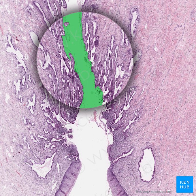 Cervical canal; Image: 