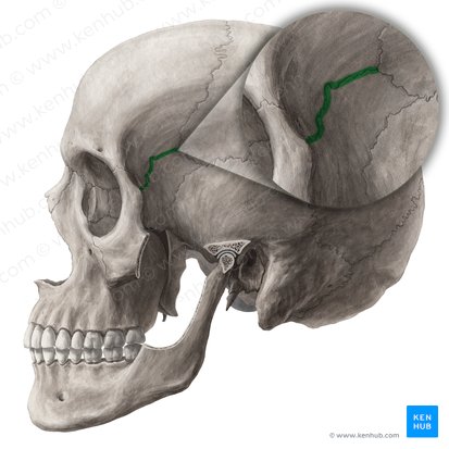 Sutura esfenofrontal (Sutura sphenofrontalis); Imagen: Yousun Koh