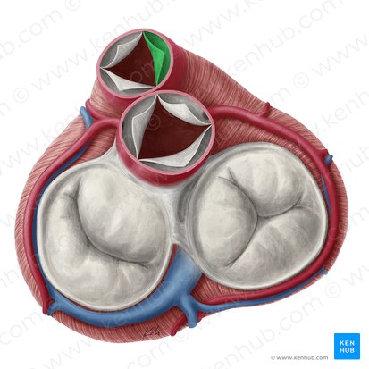 Right semilunar leaflet of pulmonary valve (Valvula semilunaris dextra valvae trunci pulmonalis); Image: Yousun Koh