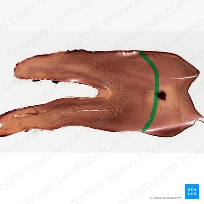 Jonction amélodentinaire; Image : 