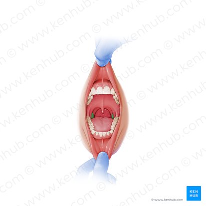 Palatine tonsil (Tonsilla palatina); Image: Paul Kim